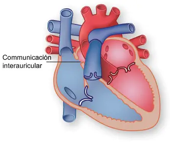 image 7 Cardiopatía congénita